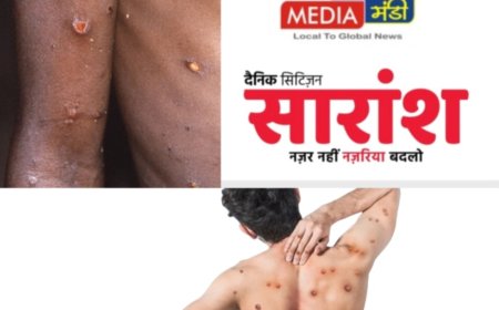 मंकी पाॅक्स वैश्विक खतरा भारत  के लिए कितना  है जोखीम  ?