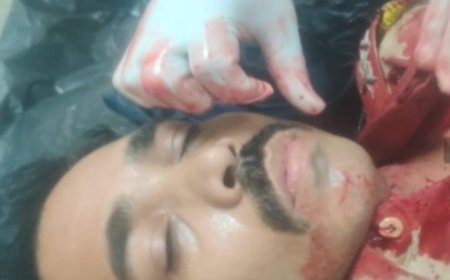 नायलॉन मांजे  से ग्रामीण पुलिस के पुलिस उपनिरीक्षक दीपक पारधे घायल