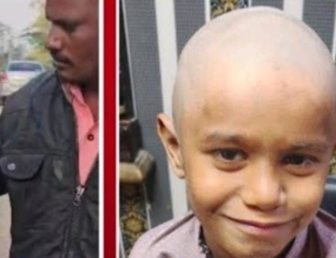 महाराष्ट्र के बुलढाना ज़िले मे रहस्य मय बिमारीका प्रकोप तिन दिन मे 300 से  ज़्यादा  लोग गंजेपन का शिकार